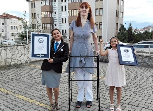 Turkey S Rumeysa Gelgi World S Tallest Woman Over 7ft Height