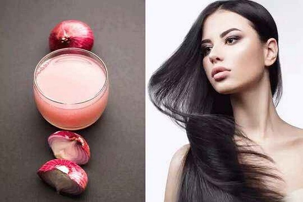 Shocking Side Effects Of Onion Juice On Hair | Man Matters