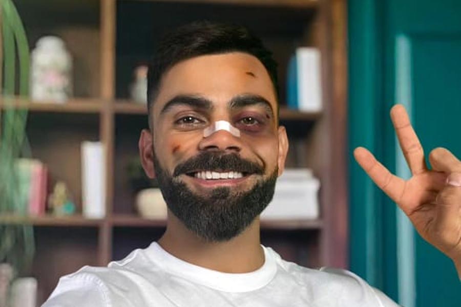 কোহলির এ কী হাল!